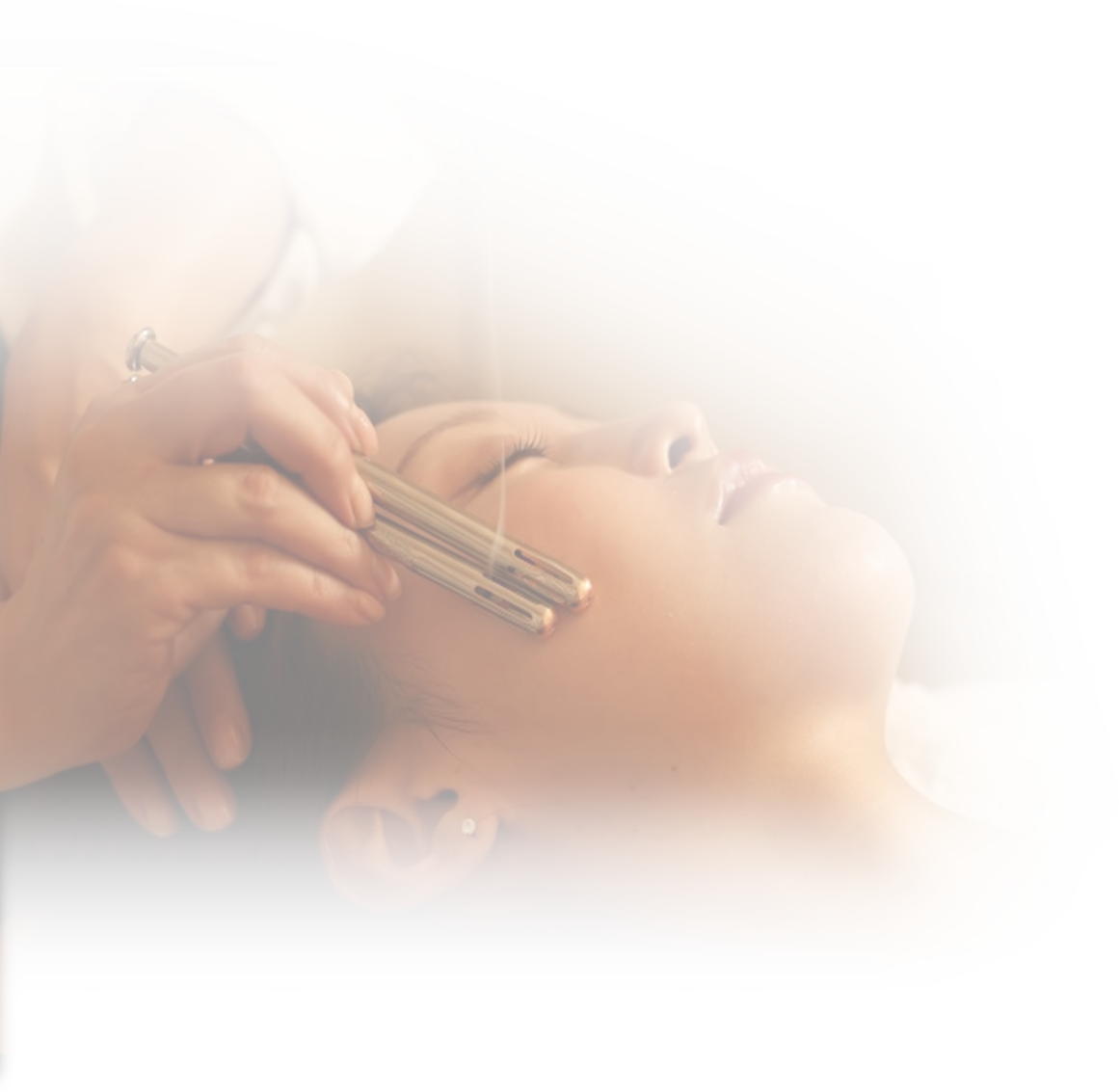 顔のイトオテルミー施術の様子