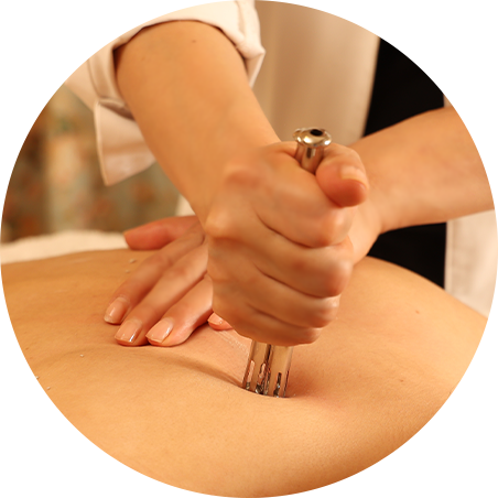 腰のイトオテルミー施術の様子